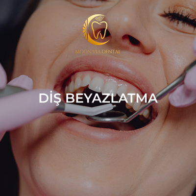 Moonvia Dental | Antalya’da Uzman Diş Kliniği ortodonti bölümü (3)