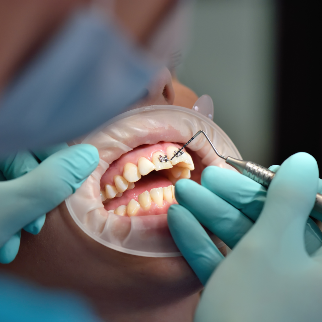 Moonvia Dental | Antalya’da Uzman Diş Kliniği www