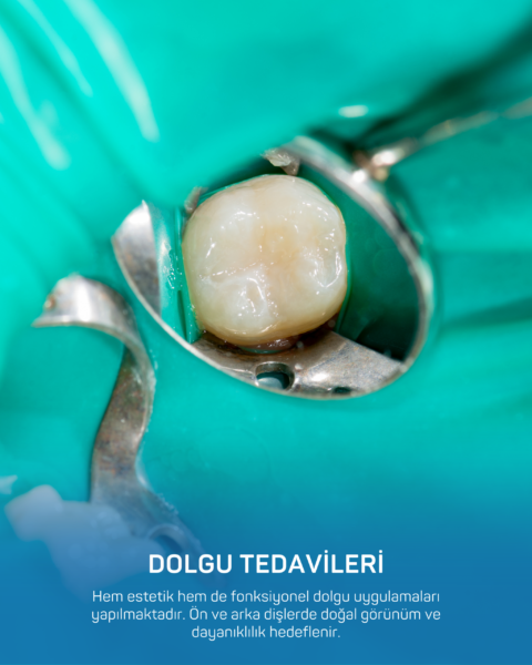 dolgu